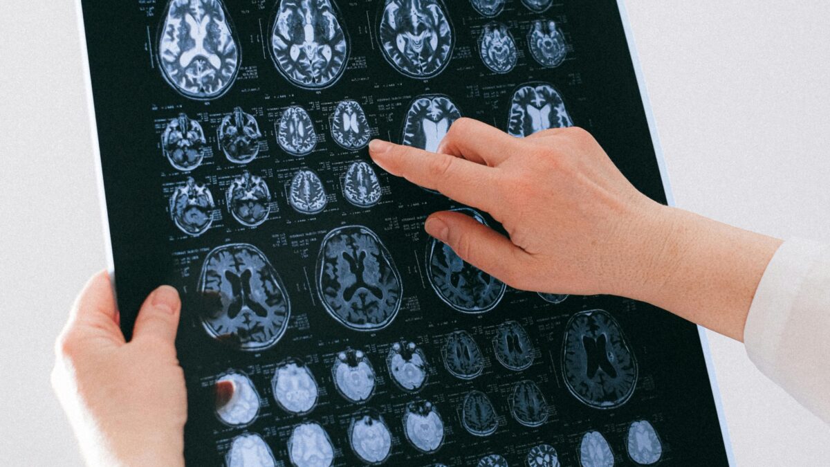 el envejecimiento del cerebro se puede revertir