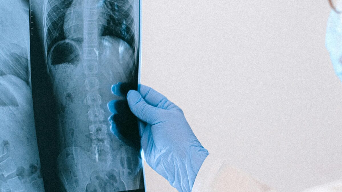 la salud de los pulmones predice la longevidad.