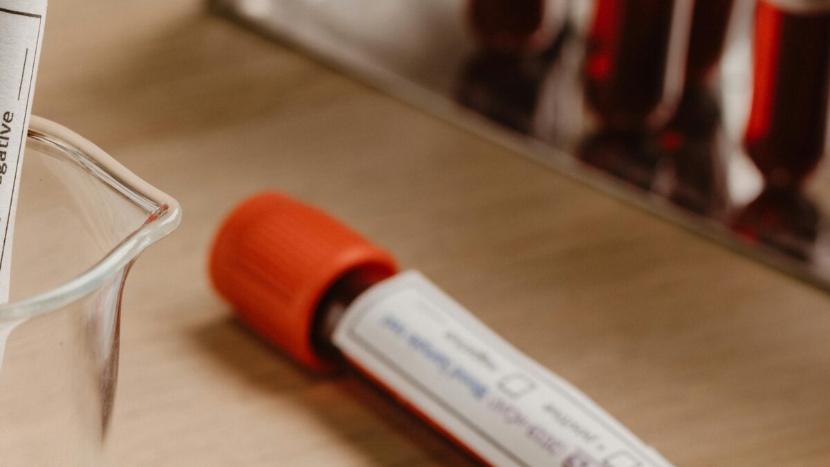 con una bioquímica sanguínea se conoce el perfil inflamatorio