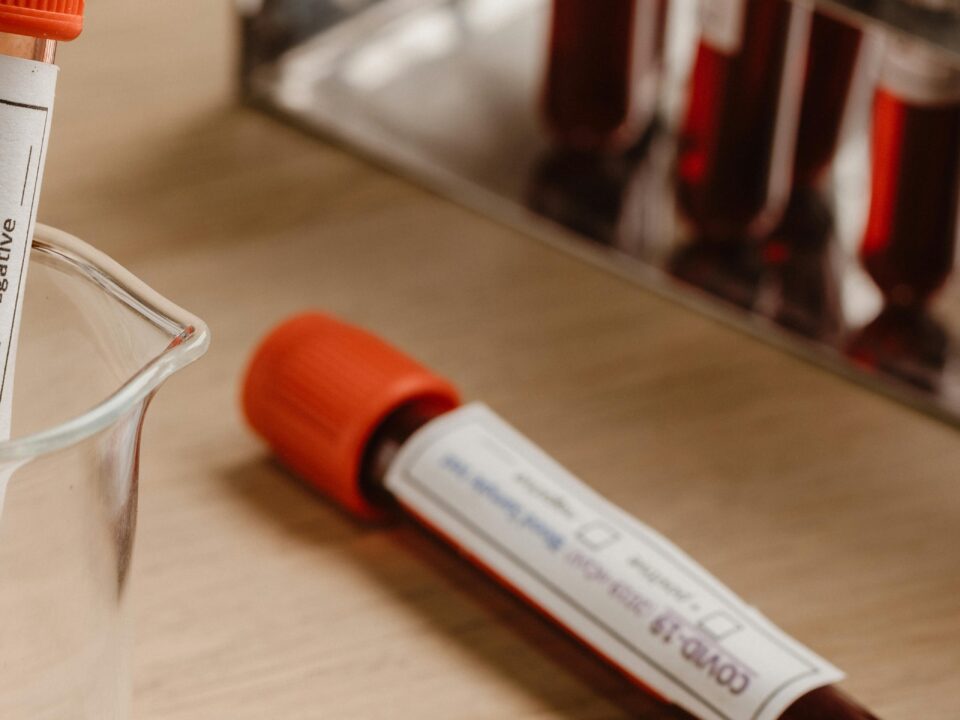 con una bioquímica sanguínea se conoce el perfil inflamatorio