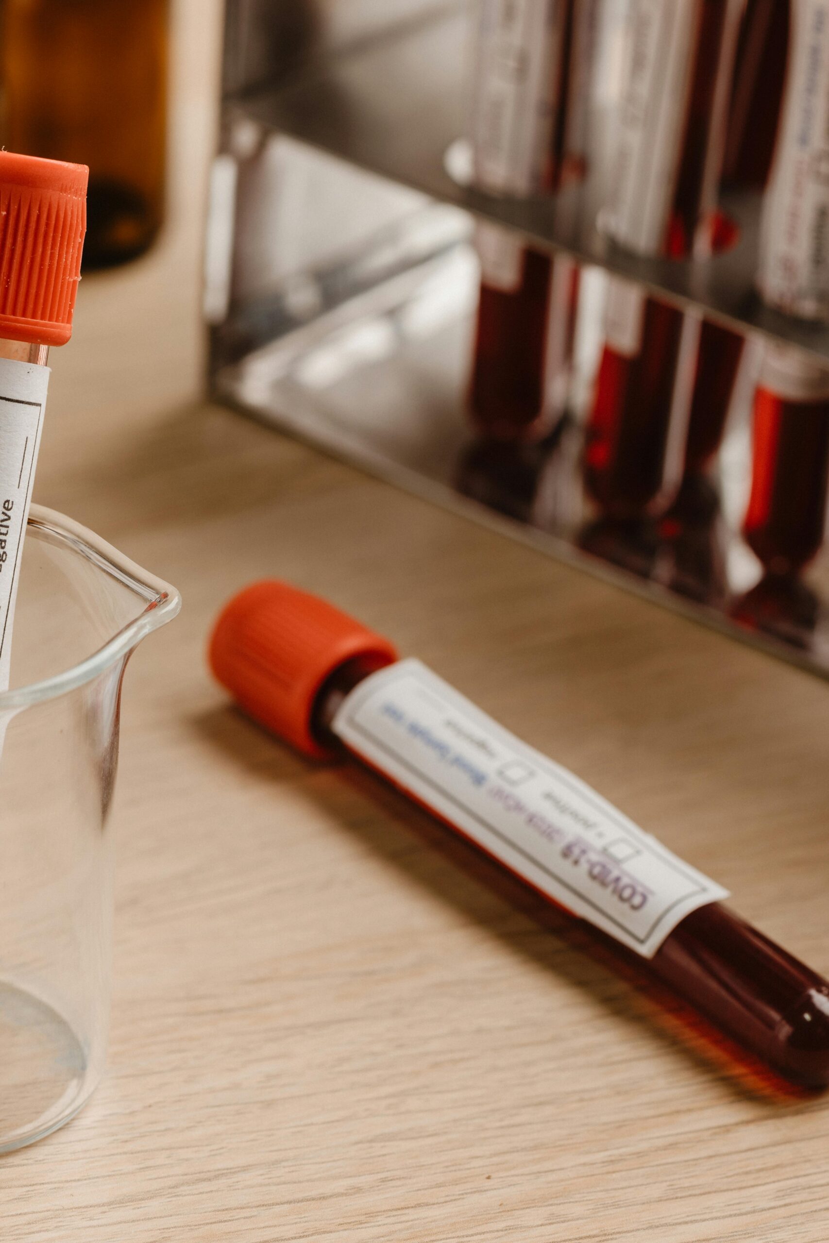 con una bioquímica sanguínea se conoce el perfil inflamatorio